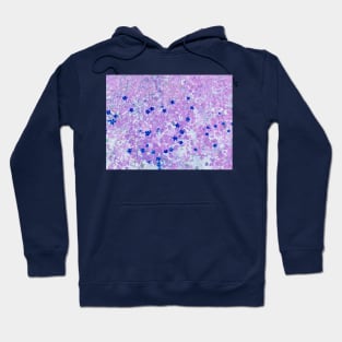 Cute pink a blue flower pattern Hoodie